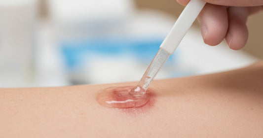 Enzyme Juice: The Next Frontier in Advanced Wound Healing?